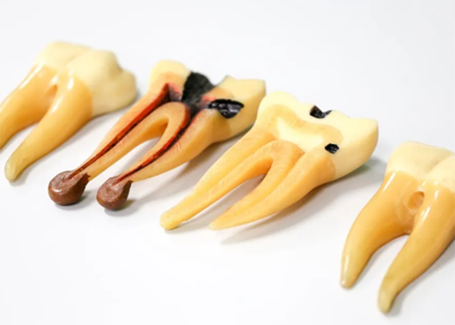 バイオフィルム